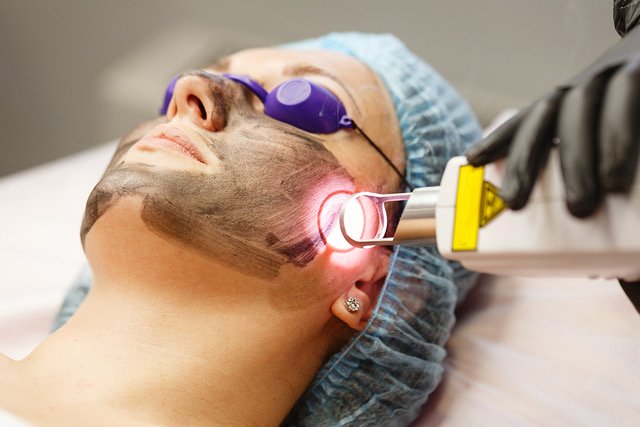 Laser Treatment